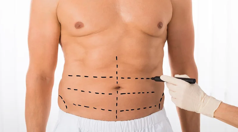 Arizona Lymphatic Massage